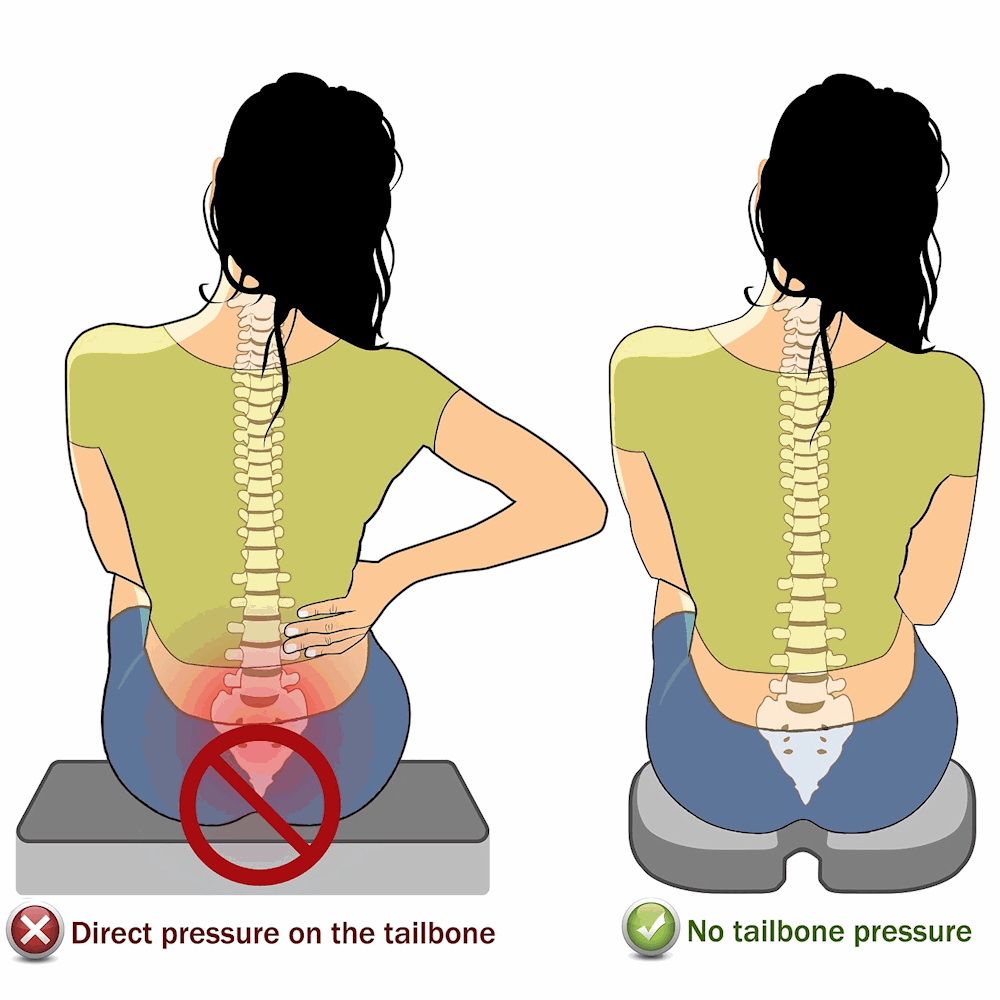 Tailbone Pain Treatment