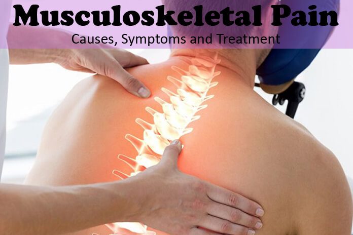 Musculoskeletal Pain - Causes, Symptoms and Treatment
