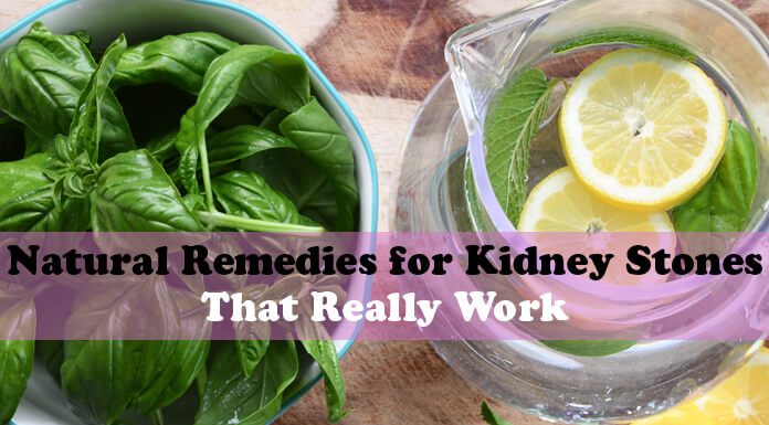 8 Natural Remedies for Kidney Stones That Really Work Natural Remedies for Kidney Stones