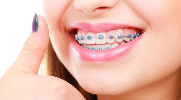 Which Mistakes Should You Avoid When Choosing An Orthodontist? Orthodontist Near Me