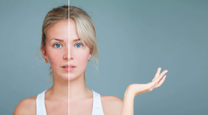 Secrets to a Healthy Body and Clear Skin Secrets to a Healthy Body & Clear Skin